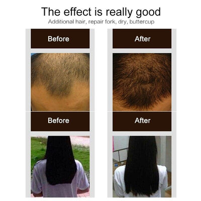 Purc Hair Growth Spray Natural Ginge